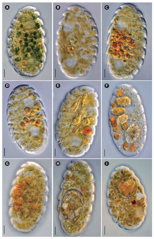 여러 먹이생물을 섭식한 절대 혼합영양성 와편모류 Polykrikos lebourae. 다양한 저서성 은편모류를 섭취한 모습(A-E)과 다양한 저서성 와편모류를 섭취한 모습(F-I)