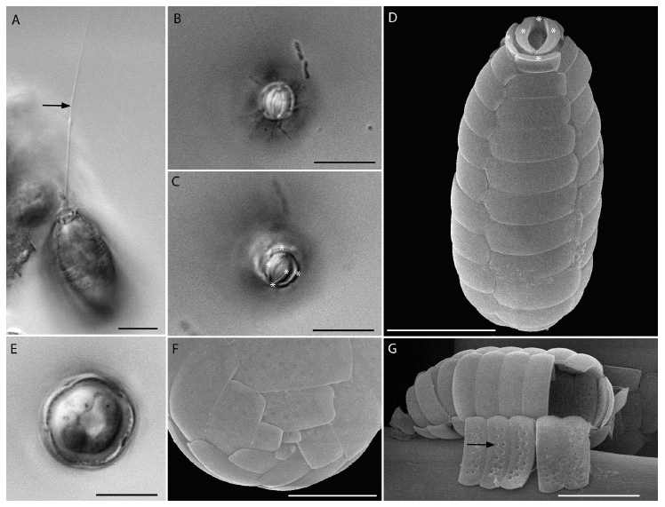 해양 원생생물인 신종 Paulinella longichromatophora의 SEM. 5개의 oral scales을 가지고 있는 점이 특징임.