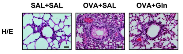 Inhibition of histological lung inflammation by oral intake of Gln.