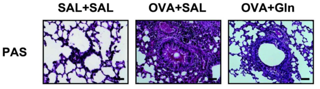 Inhibition of mucus production by oral intake of Gln.