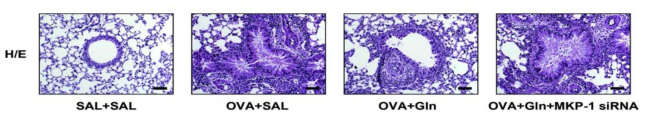 Reverse of inhibitory effect of Gln on mucus production by MKP-1 siRNA pretreatment.