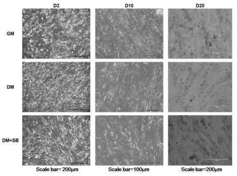저분자 물질이 도입된 근골격계 분화 유도 배지에 따른 분화