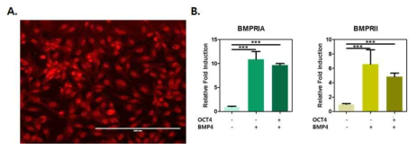 Transfection 효율과 BMP-4 수용기의 유전자 발현 율