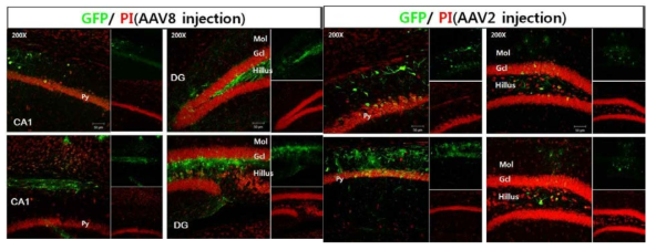 GFP-AAV를 쥐뇌에 stereotaxic 주입하 고 감염 효율 조사