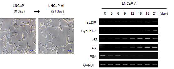 안드로겐 의존적에서 비의존적 전립선암으로 전환에 따른 sLZIP과 cyclin D3의 발현의 증가.