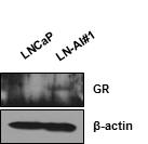 LNCaP-AI에서 GR 단백질 발현 증가.
