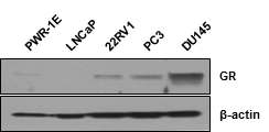 세포주별 GR 발현 비교