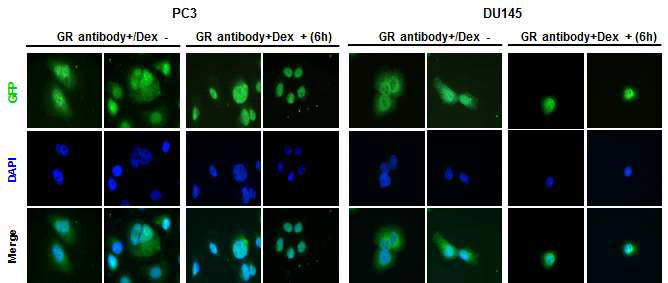 안드로겐 비의존적 전립선암 세포주에서 Dex의 처리에 따른 GR의 위치변화.