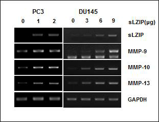 안드로젠 비의존적 전립선암 세포에서 sLZIP에 의한 MMPs 발현 변화.