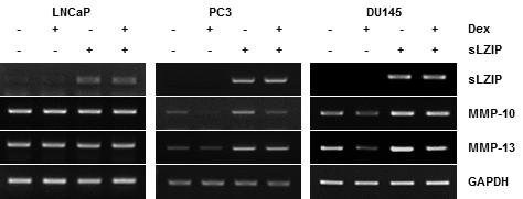 안드로겐 비의존적 전립선암 세포주에서 sLZIP과 GR이 복합적으로 작용에 따른 MMP-10, MMP-13 mRNA양 조절.