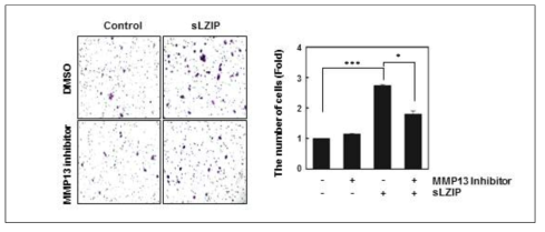 안드로겐 비의존적 전립선암 세포주에서 sLZIP에 의한 암세포 이동성 증가 및 MMP-13 억제제에 의한 이동성 감소.