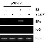 sLZIP의한 ER의 ERE 결합 저해