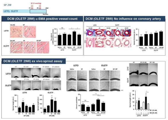OLETF 당뇨성 심부전에서 SP에 의한 혈관 재생 효과