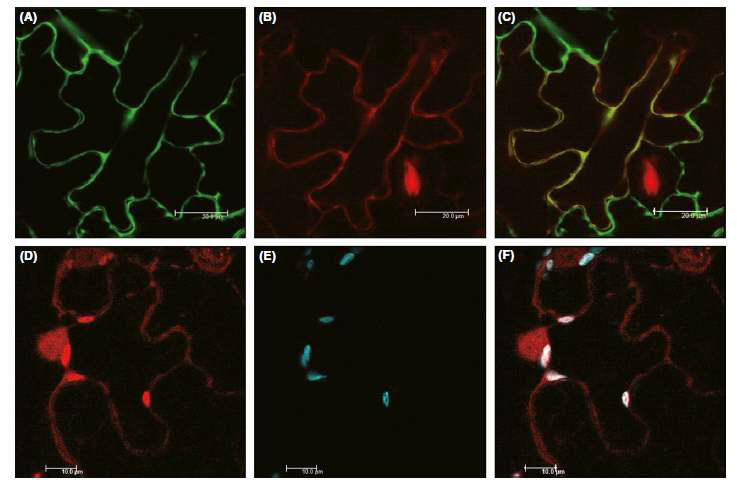 SNAT2 단백질의 식물세포 내 발현 confocal microscopy 분석