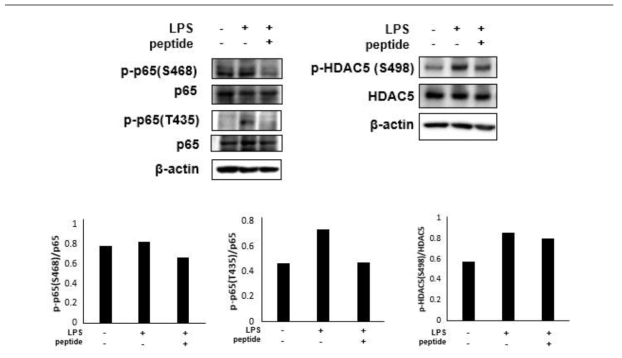 phosphorylation 확인을 위한 western blot 결과