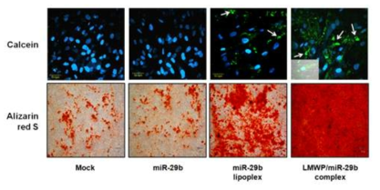 miR-29b lipoplex와 complex의 transfection을 통한 칼슘침착정도 비교