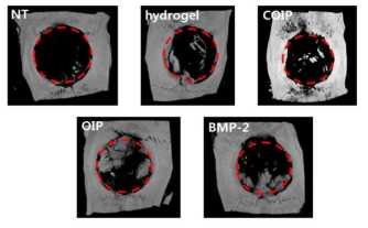 두개골 결손 모델평가 후 micro-CT 3D 이미지