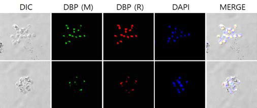 IFA를 이용하여 두 종류의 실험으로 발현된 PvDBPⅡ 단백질을 실험동물에 면역하여 얻은 항체의 활성을 비교 및 분석