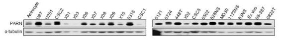 다양한 뇌종양 세포주 및 뇌종양 환자유래 줄기세포에서 PARN 발현 확인