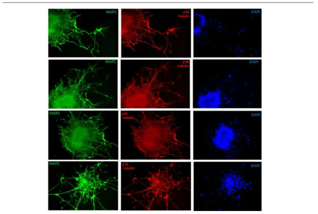 줄기세포로부터 성숙한 신경세포로의 분화 확인