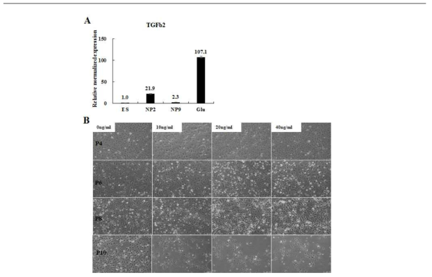 분화단계에서 TGF-β2 발현 변화 및 TGF-β2 첨가 배지 에서 신경전구세포의 형질 변화