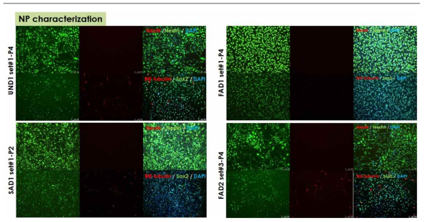 역분화 줄기세포 유래 신경전구세포의 분화 조건 확립 및 분화 특성 검증