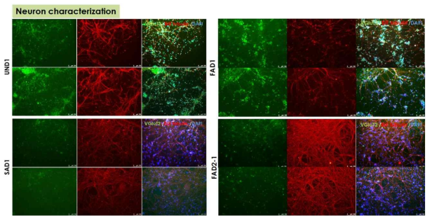 역분화 줄기세포 유래 Glutamatergic neuron 분화 조건 확립 및 분화 특성 검증