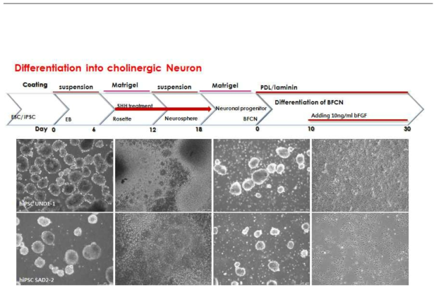 역분화 줄기세포 유래 cholinergic neuron 분화 조건 확립