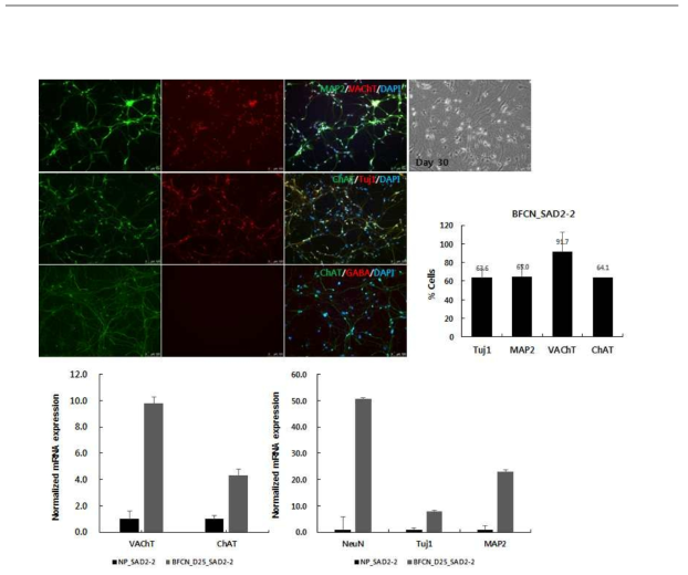 역분화 줄기세포 유래의 cholinergic neuron 분화