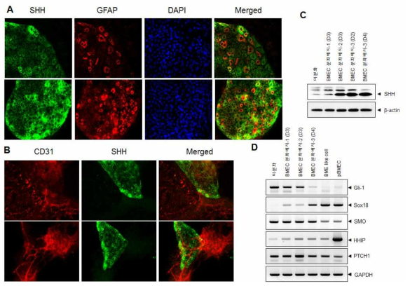 뇌혈관내피세포로의 분화단계별 SHH의 발현 분석