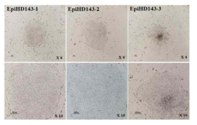 episomal vector방식을 통해 제작된 3종의 iPSC (EpiHD143)
