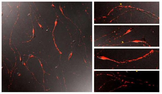 iPSC 유래 신경세포를 대상으로 mitochondria의 이동양상 조사
