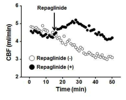 Repaglinide의 혈류량 증가 효과