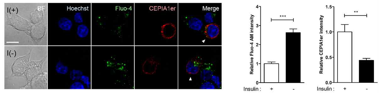 성체신경줄기세포에서 인슐린 결핍으로 인해 발생하는 오토파지 세포사멸 시 외부의 Ca2+의 유입 없이 내부의 Ca2+양이 증가하는 것을 분석