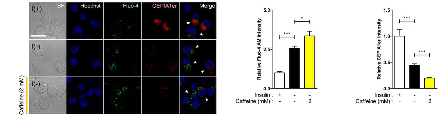 인슐린 결핍된 성체신경줄기세포에서의 증가된 세포 내부 Ca2+양에 대한 분석