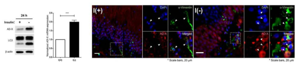 인슐린제거에 의한 해마신경줄기세포에서의 AD-X 발현 증가