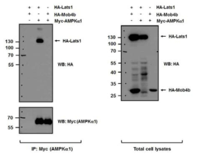 AMPK와 상호작용하는 Hippo 신호전달계 타겟 단백질 분석결과