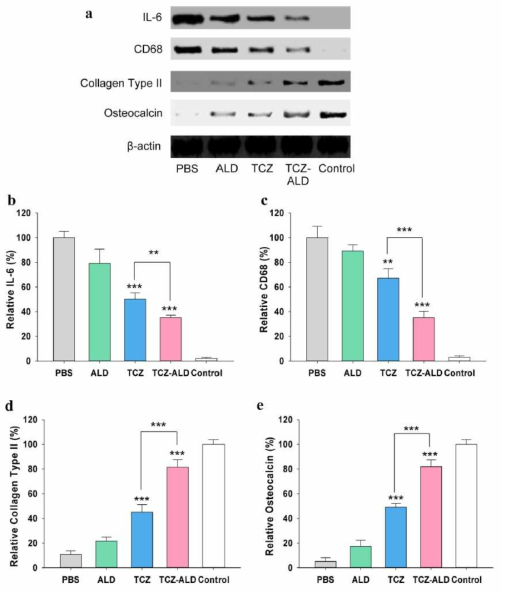 해부 된 관절 조직에서 IL-6, CD68, II 형 콜라겐, osteocalcin의 (a) Western blot 분석 농도 측정 분석 (b) IL-6, (c) CD68, (d) 콜라겐 II 형 및 (e) 오스테오칼신 비교시 ** P <0.01 및 *** P <0.0001의 값.