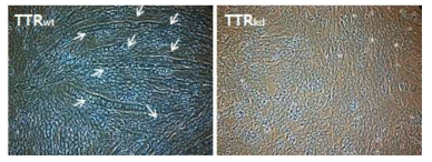 위 그림은 TTR 유전자의 발현 억제 후 세포형태를 관찰하기 위해 giemsa 염색을 한 모습이다.