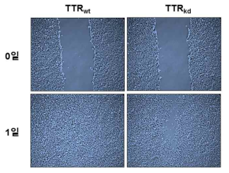 위 그림은 TTR 유전자의 발현이 억제된 세포와 대조군 세포가 약 100% 성장하였을 때 scratch를 한 후 1일 동안 세포의 회복정도를 관찰한 결과이다