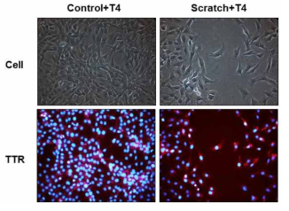 위 그림은 scratch를 가하고 T4 호르몬을 처리하여 1일 동안 방치한 세포에서 TTR 단 백질의 발현을 면역염색법 (immunocytochemistry)으로 관찰한 결과이다