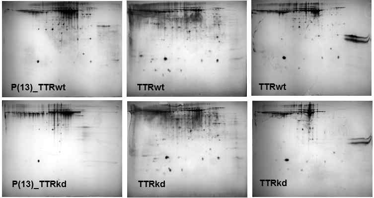 위 그림은 TTR 유전자의 발현을 억제한 세포와 억제하지 않은 세포를 무혈청 배지에서 2일 동안 배양한 후 배양한 배지에서 단백질을 추출하여 2D 겔을 분석을 진행한 결과이다