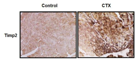 위 그림은 쥐의 다리 근육에 CTX를 처리하고 3일 후 다리근육에서 Timp2 단백질의 발현을 면역염색법 (immunohistochemistry)으로 관찰한 결과이다