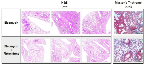 블레오마이신으로 폐섬유화를 유발한 C57BL/6 마우스와 피르페니돈을 C57BL/6 마우스의 기관을 통해 폐투여 후 폐조직 사진 (폐섬유화 조직 고찰)