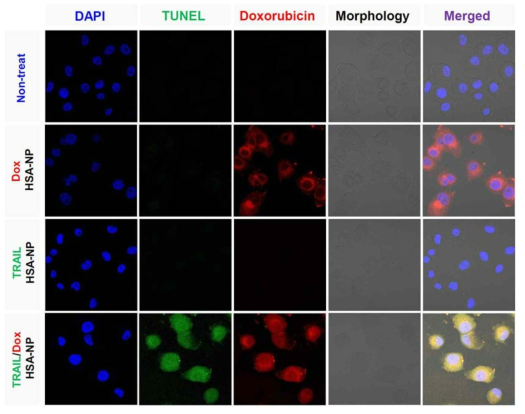 폐암 세포주(H226)에서 알부민 나노입자의 효과를 나타낸 Confocal laser scanning microscopy (CLSM) 이미지