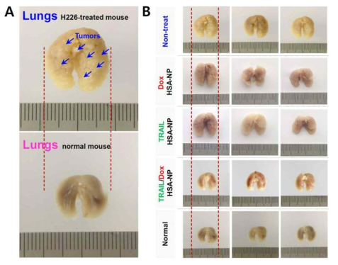 H226 세포가 이식된 마우스에 대한 TRAIL/독소루비신 알부민 나노입자의 항암 효과
