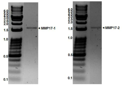 The PCR products of MMP17-1 and MMP17-2 full-length cDNA