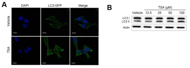 Ts A 투여에 따를 autophagy 확인.