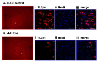 시상전달핵에 국소적으로 PLCβ4 유전자 넉다운