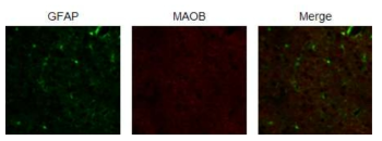 성상교세포 내에 MAOB의 발현 확인